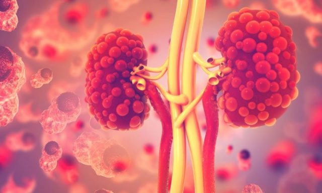 Kidney Disease Research